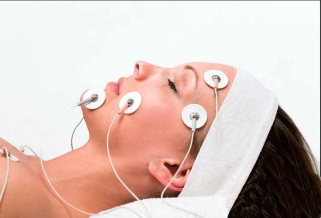 Electroterapia en parálisis facial 2024 Kinesiología